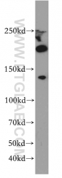 19915-1-AP - JMJD1B / KDM3B