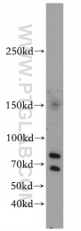 19915-1-AP - JMJD1B / KDM3B