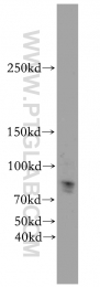 19915-1-AP - JMJD1B / KDM3B