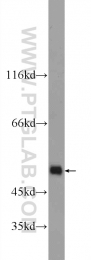 24943-1-AP - JMJD2A / KDM4A