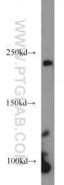 18825-1-AP - KDM5A / JARID1A