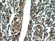 21444-1-AP - KIAA0226