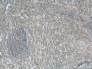 21444-1-AP - KIAA0226
