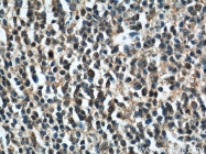 21444-1-AP - KIAA0226