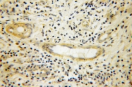 12345-1-AP - DYNC1H1