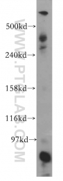 12345-1-AP - DYNC1H1