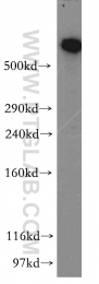 12345-1-AP - DYNC1H1