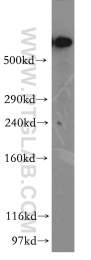 12345-1-AP - DYNC1H1