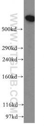 12345-1-AP - DYNC1H1