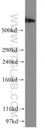 12345-1-AP - DYNC1H1