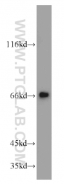 20959-1-AP - MRPP3