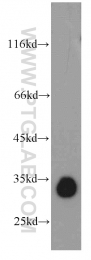 21478-1-AP - KIAA0513