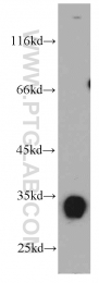 21478-1-AP - KIAA0513