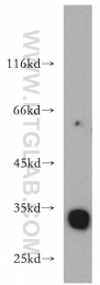 21478-1-AP - KIAA0513