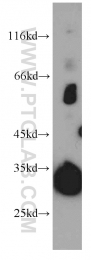 21478-1-AP - KIAA0513