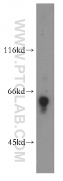 18258-1-AP - ATG13