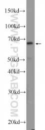 25419-1-AP - KIAA0907 / BLOM7