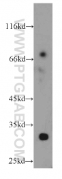 20637-1-AP - KIAA1191