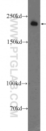 25712-1-AP - KIAA1429