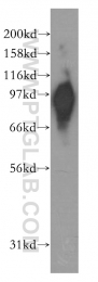 12700-1-AP - KIFAP3 / SMAP