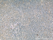 17583-1-AP - KIR3DX1