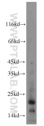 18375-1-AP - KiSS-1