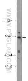 25224-1-AP - BTBD5 / KLHL28