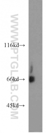 16951-1-AP - KLHL3