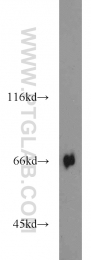 16951-1-AP - KLHL3