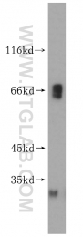 16951-1-AP - KLHL3