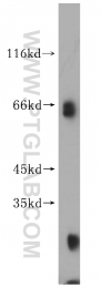 16951-1-AP - KLHL3