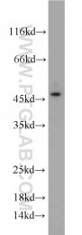 10815-1-AP - KLK1 / Kallikrein-1