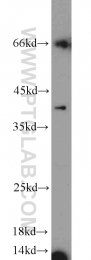 12698-1-AP - KLK11 / Kallikrein-11