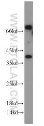 12698-1-AP - KLK11 / Kallikrein-11