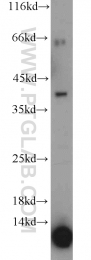 12698-1-AP - KLK11 / Kallikrein-11