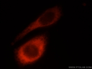 23498-1-AP - Laminin beta-1 / LAMB1