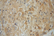 14612-1-AP - Cytosol aminopeptidase