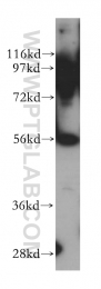 14612-1-AP - Cytosol aminopeptidase