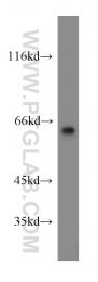 12483-1-AP - LGI1 / EPT