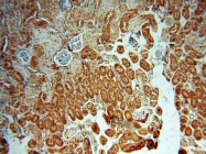15759-1-AP - LHPP