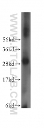 15759-1-AP - LHPP