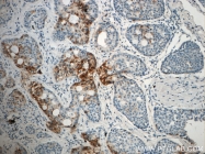 21133-1-AP - LIPC / Hepatic lipase