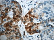 21133-1-AP - LIPC / Hepatic lipase