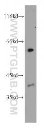 21133-1-AP - LIPC / Hepatic lipase