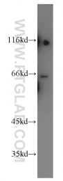 21133-1-AP - LIPC / Hepatic lipase