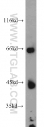 21133-1-AP - LIPC / Hepatic lipase
