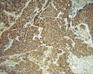 15440-1-AP - LONP1 / PRSS15