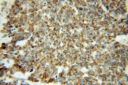 15440-1-AP - LONP1 / PRSS15
