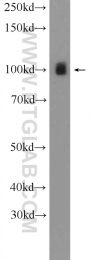 15440-1-AP - LONP1 / PRSS15