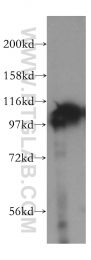 15440-1-AP - LONP1 / PRSS15